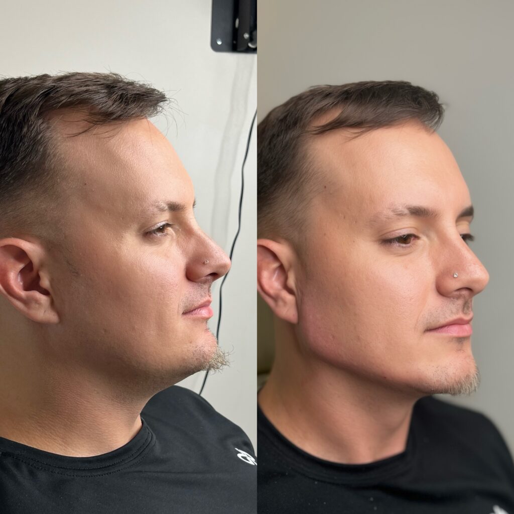 Facetune 30 07 2024 21 46 01 (1)